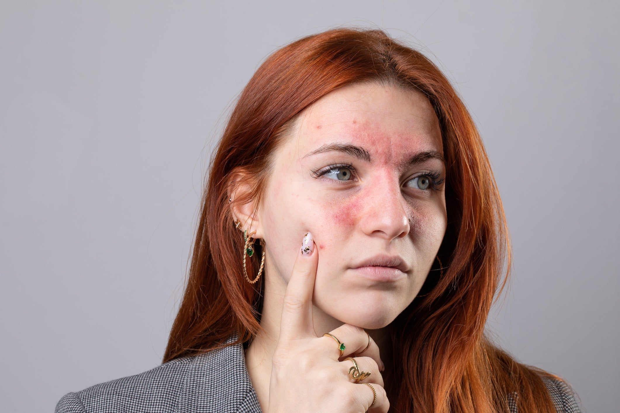 Red Cheeks? Your Skin Is Talking to You. – O'Black Cosmetics