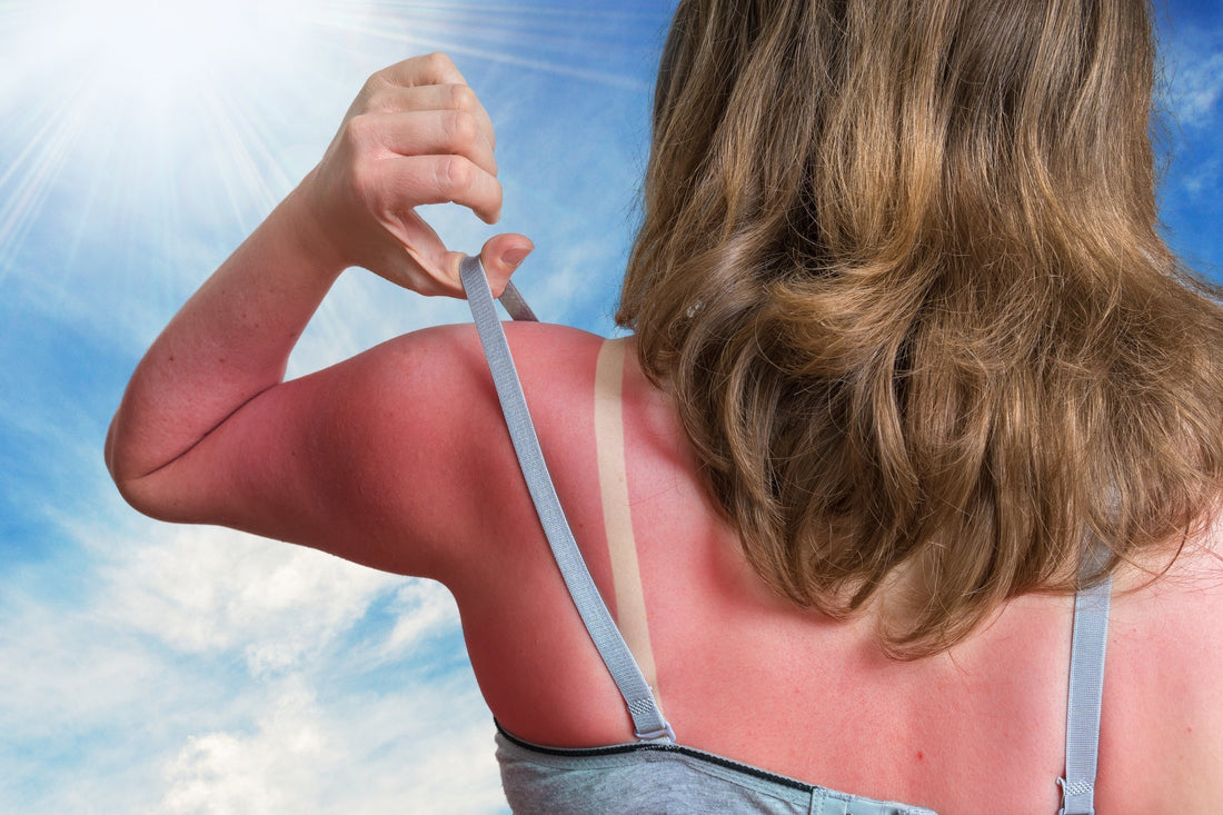 Why SPF Matters in New Zealand: Part 1